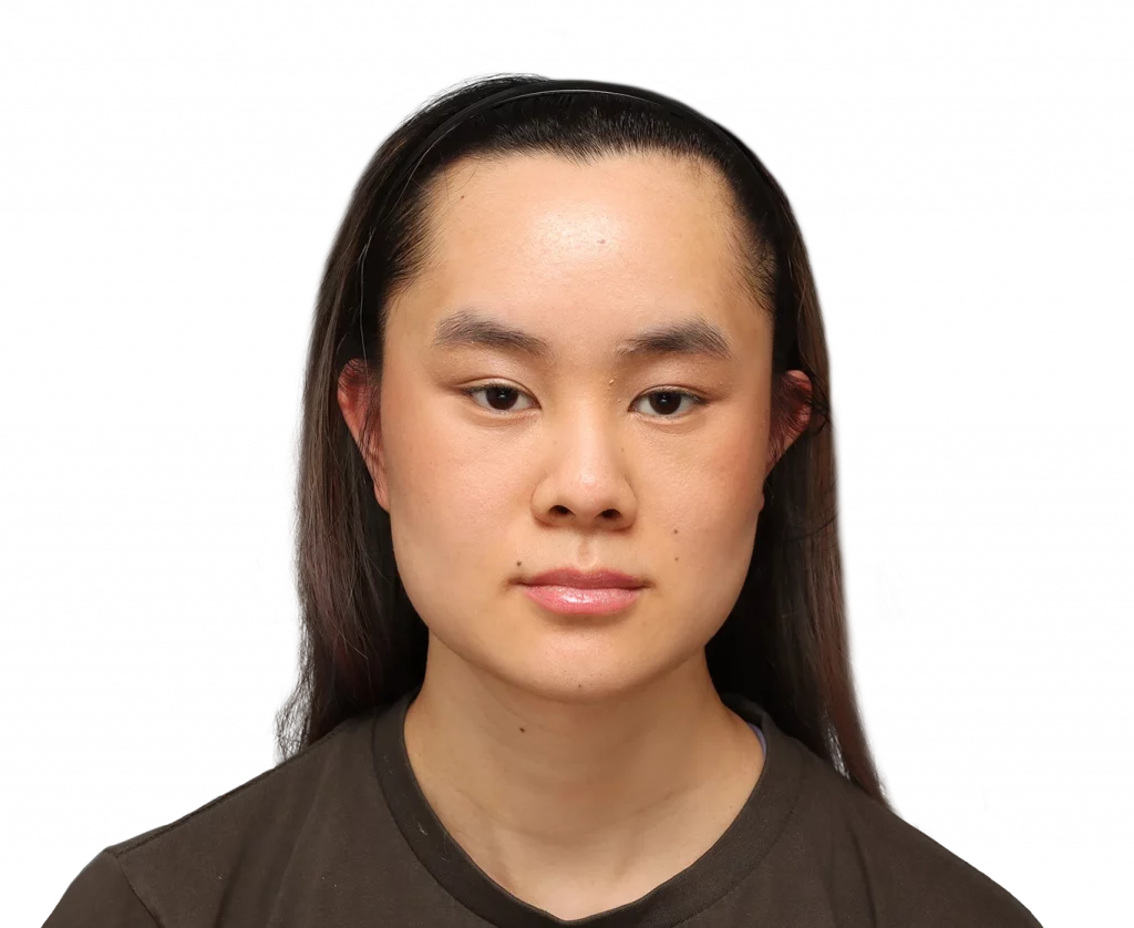 Foto de perfil frontal de Val después de la cirugía.