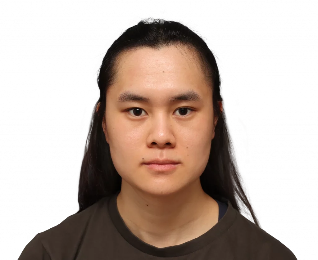 Foto de perfil frontal de Val antes de la cirugía.