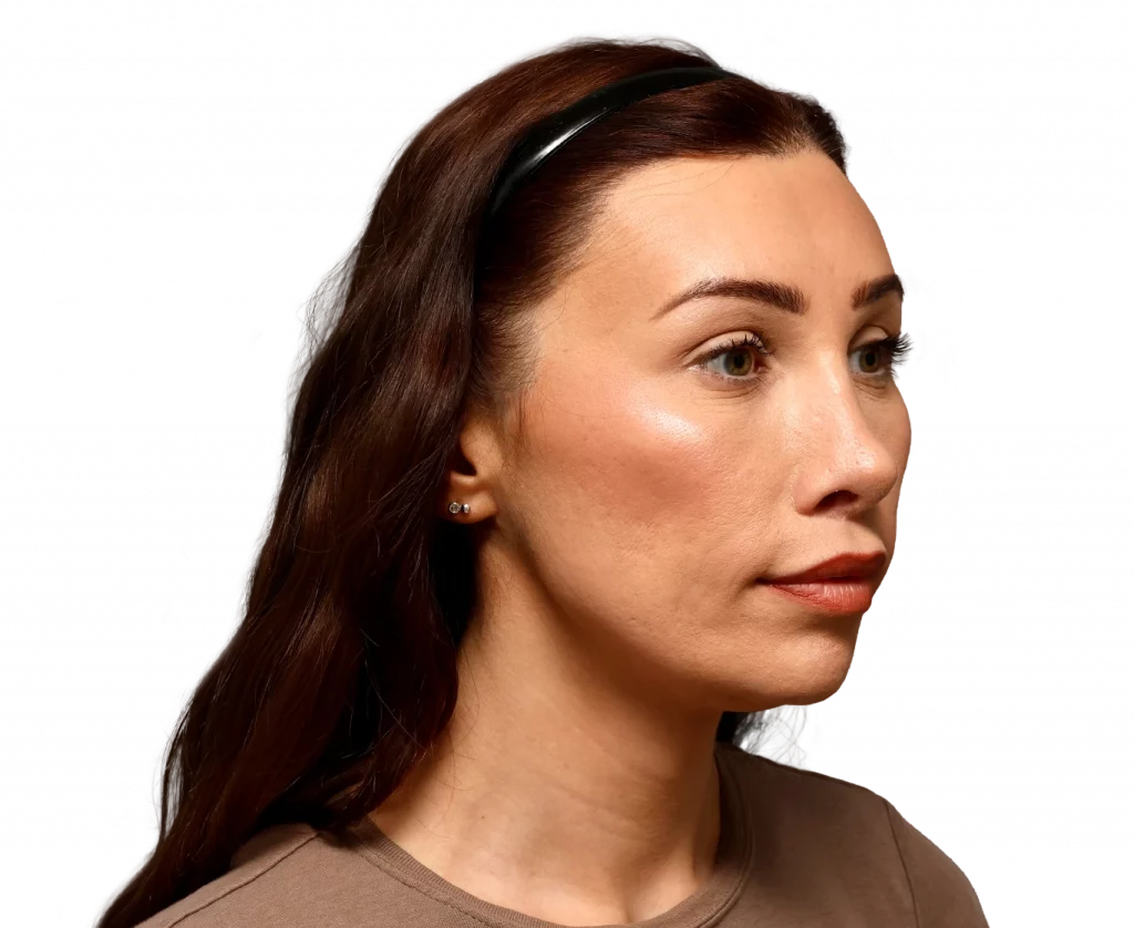 Side profile of a woman with brown hair wearing a black headband, looking to the right.