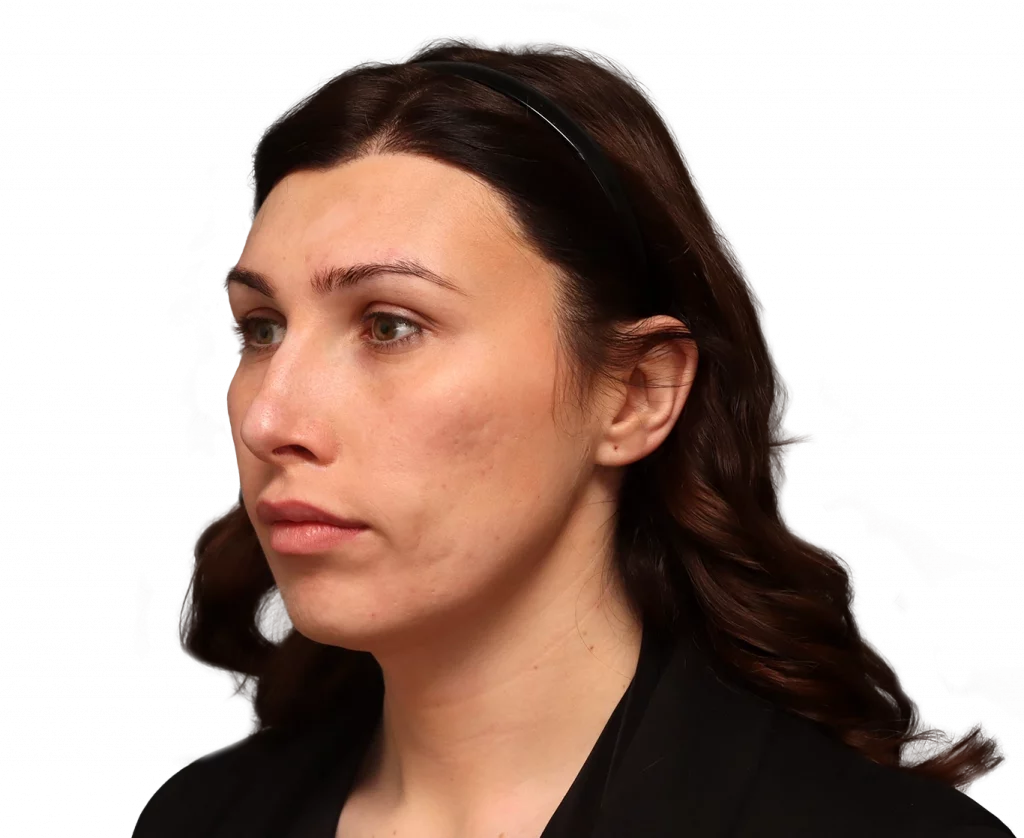 Portrait of a woman in a black blazer, left-facing profile with a black headband and neutral expression.
