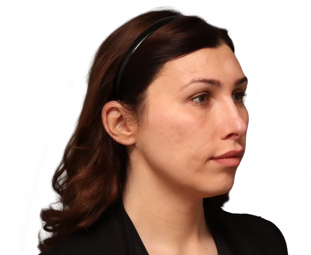 Profile view of a woman with brown hair pulled back by a black headband, looking to the right.