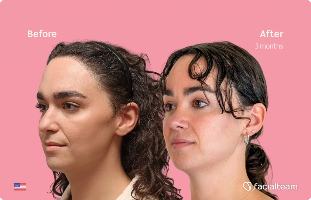 Split-screen before-and-after of two women showing facial treatment results after 3 months; pink background, Facalteam logo