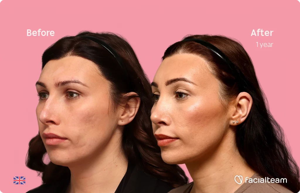 Side-by-side portrait: left shows the subject before treatment, right after one year, against a pink backdrop.