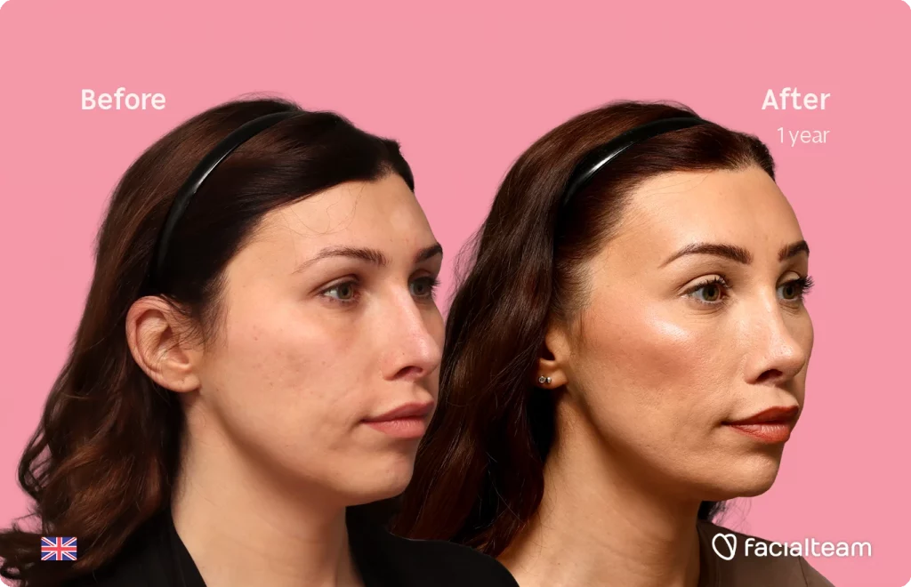 Before and after photos of a woman against a pink backdrop, showing skin improvement after one year of treatment.