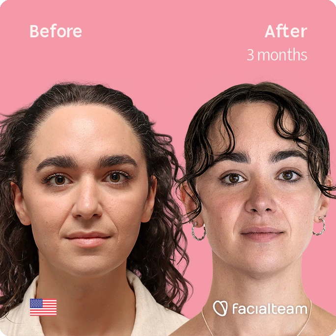 Side-by-side portrait of a woman before and after 3 months of treatment on a pink background (Before on left, After on right).