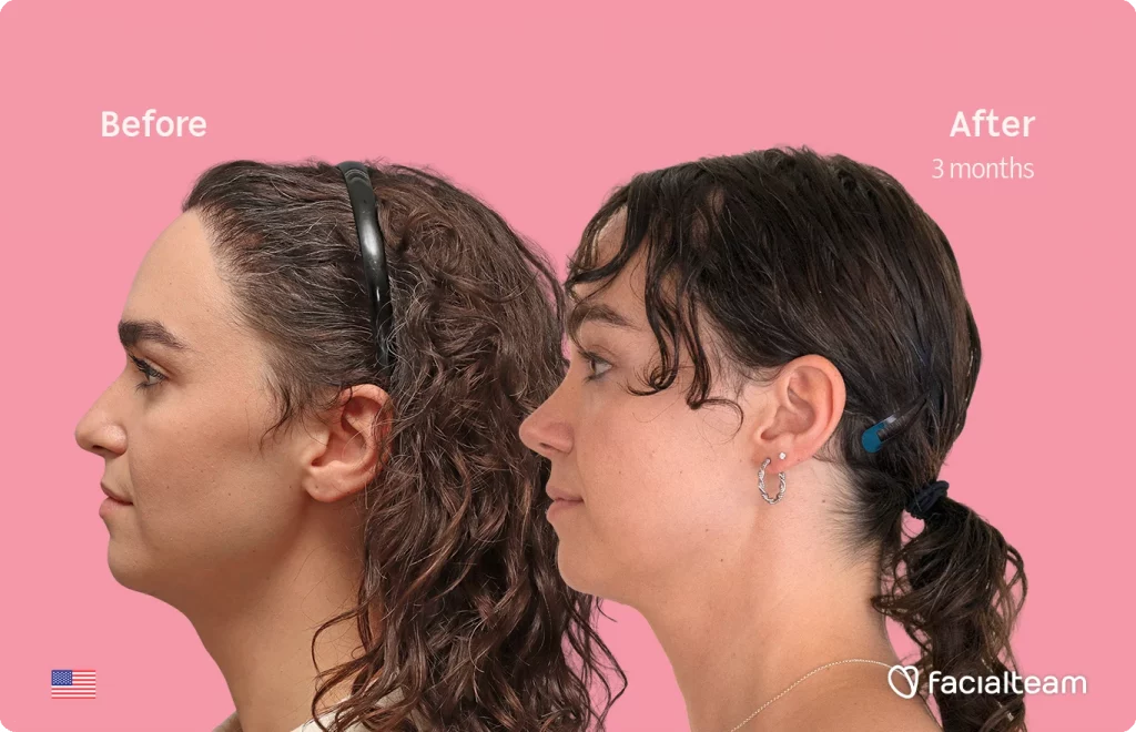 Side-by-side profile of a woman before and after a treatment, pink background, 'Before' left and 'After 3 months' right, facial improvement implied.