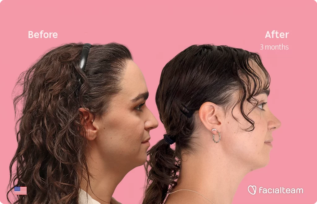Side-by-side profile of a woman before (left) and after 3 months of treatment, showing thicker hair growth against a pink background.