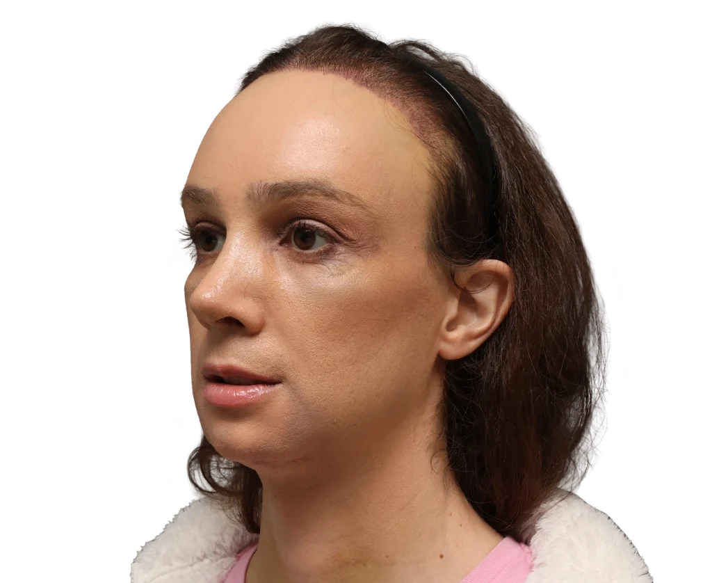 Profile view of a woman facing left, showing her head and shoulders with brown hair and subtle makeup, wearing a pink top and white fleece collar.