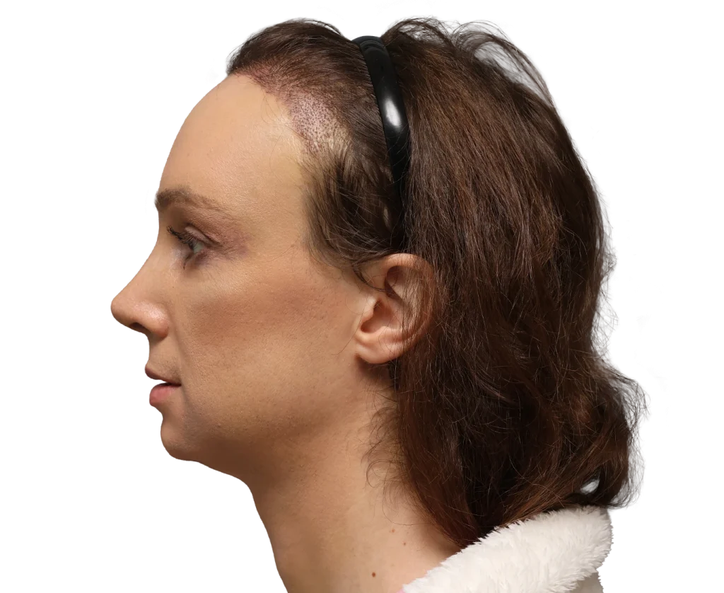 Profile view of a woman with brown hair wearing a black headband, facing left.