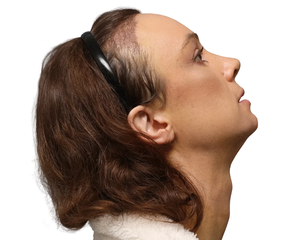 Profile of a woman with brown hair wearing black over-ear headphones, looking upward as if listening intently