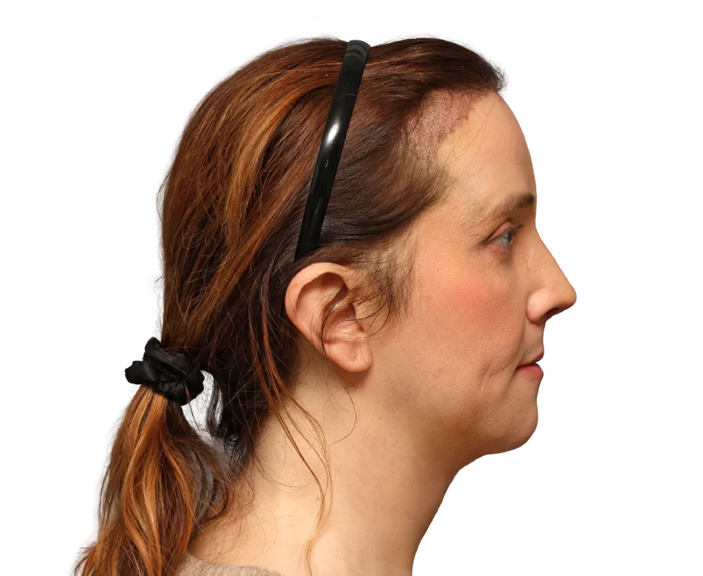 Profile of a woman facing right with brown hair held back by a black headband
