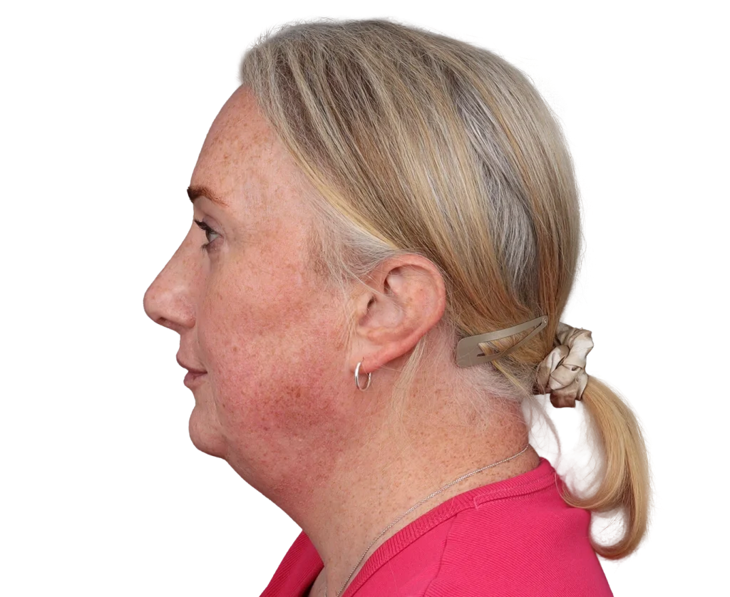 Profile view of a middle-aged woman with blonde hair tied in a low ponytail, wearing a pink shirt.