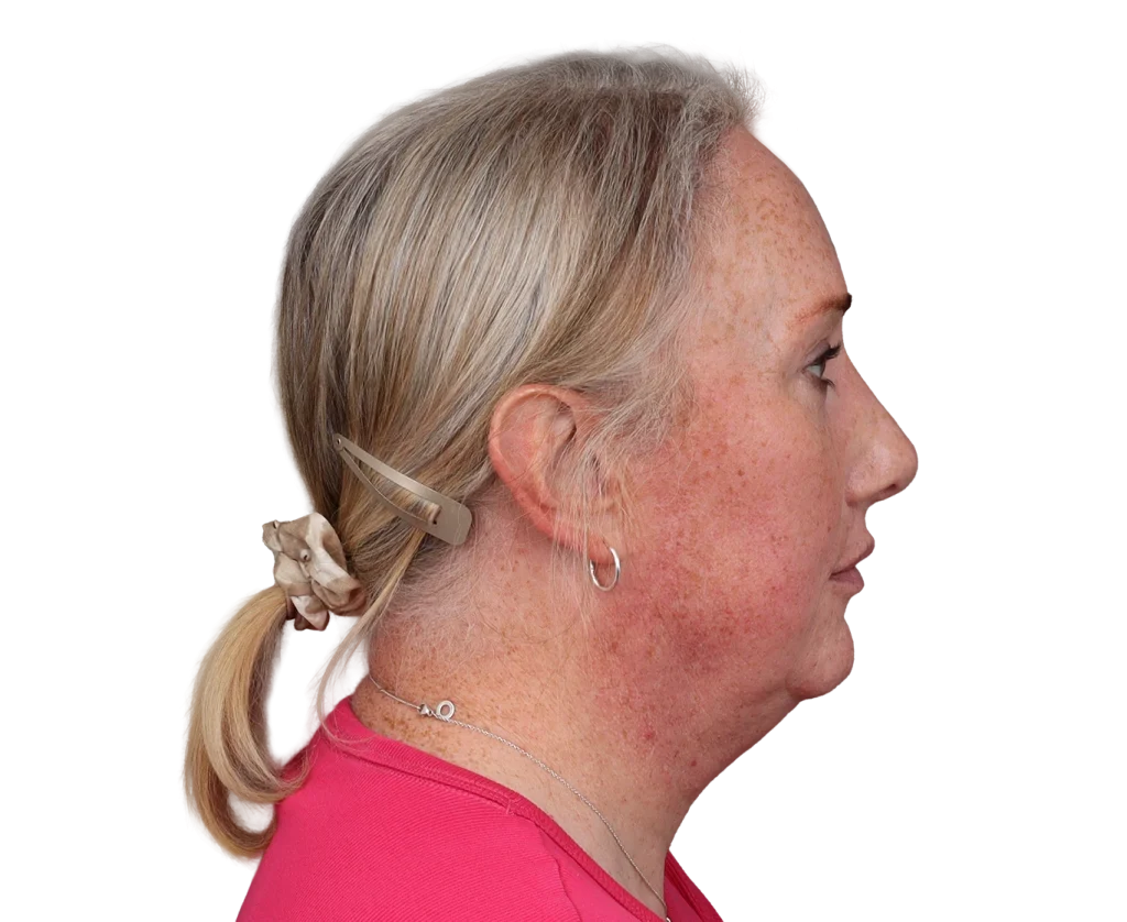 Side profile of an older woman with blonde hair in a low ponytail secured by a beige barrette and scrunchie, wearing a silver hoop earring and a pink top.