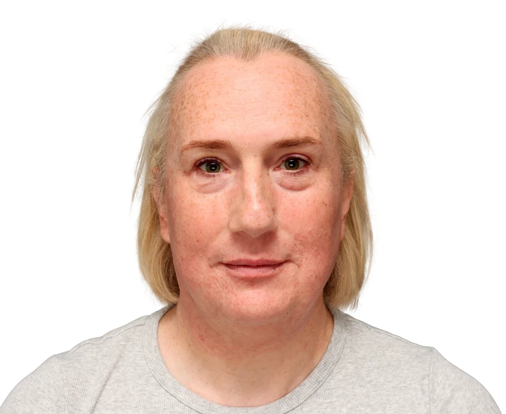 Front-facing portrait of a woman with light blonde hair, freckles, and a neutral expression, wearing a gray shirt.