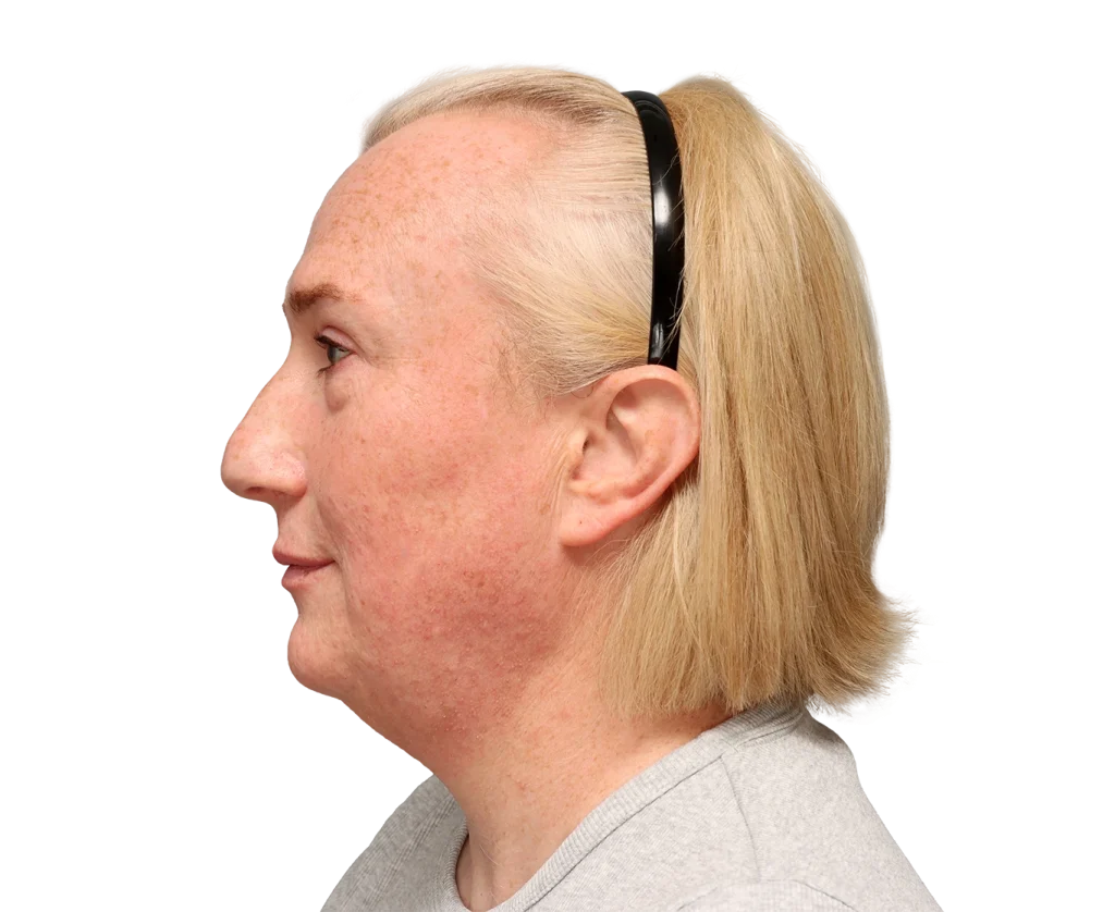 Side profile of a blonde woman wearing a black headband, freckles on her face, looking to the left.