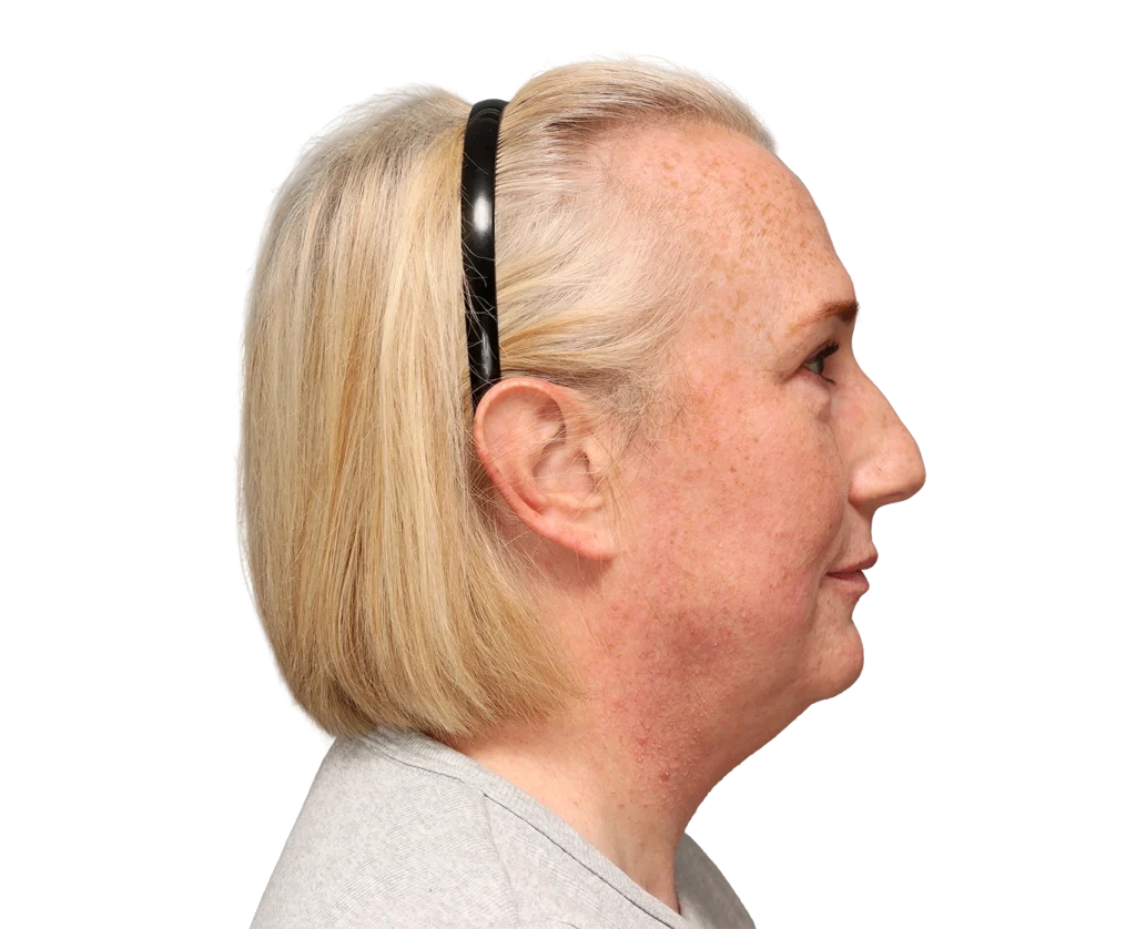 Side profile of a middle-aged woman with blonde hair wearing a black headband, freckles, and a gray shirt.