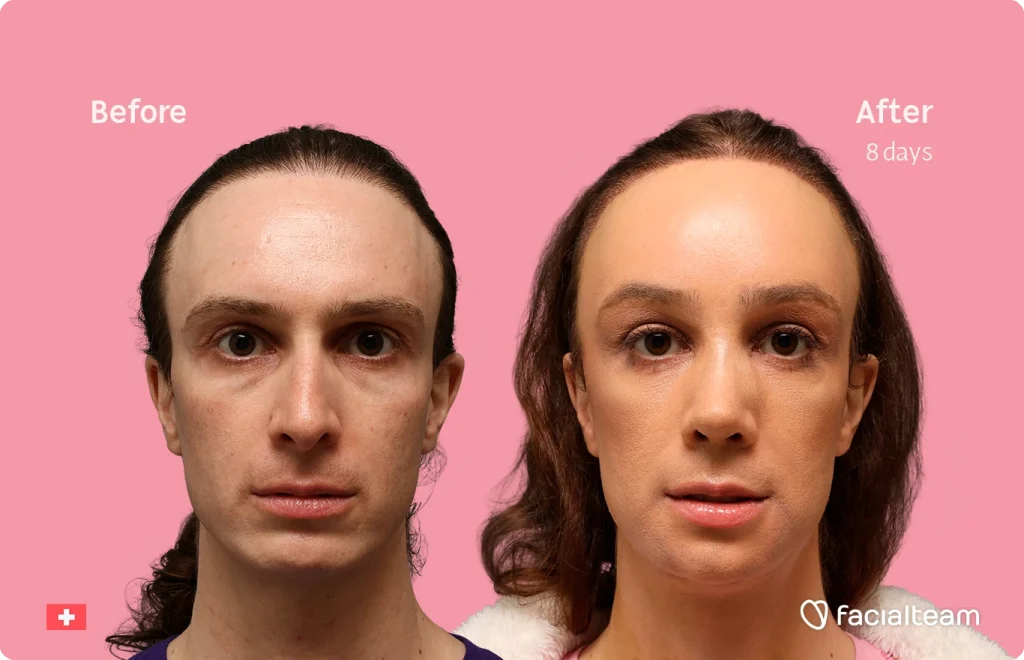 Side-by-side portraits on a pink background labeled Before and After (8 days), showing facial skin improvement.