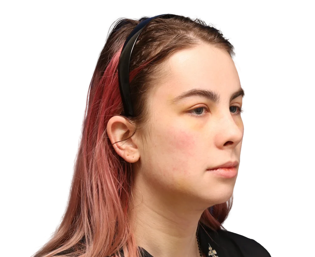 Side profile of a young woman with pink-tinted hair wearing a black headband