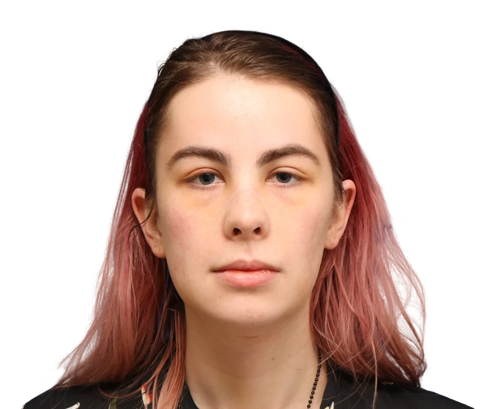 Close-up portrait of a young woman with pink-tinted hair, neutral expression, looking straight ahead.