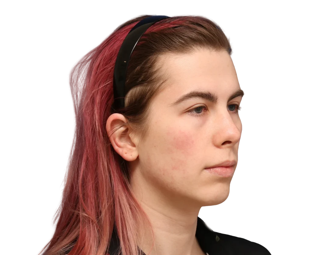 Portrait of a woman with pink hair wearing a black headband, facing right.