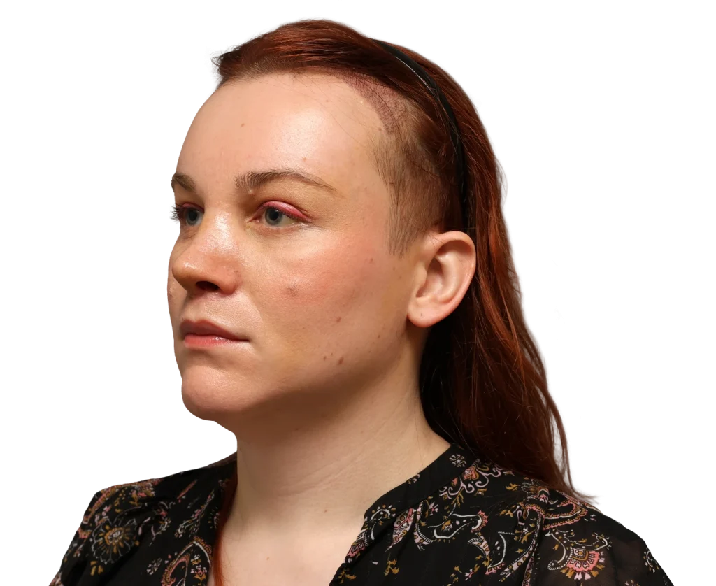 Side profile of a woman with red hair wearing a patterned black blouse, looking to the left.