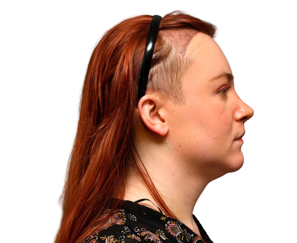 Profile view of a person with long red hair, shaved sides, and a black headband.