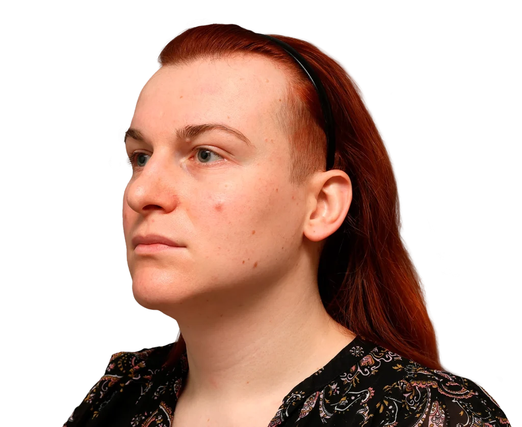 Side profile of a person with red hair wearing a black headband, looking to the left against a dark background.