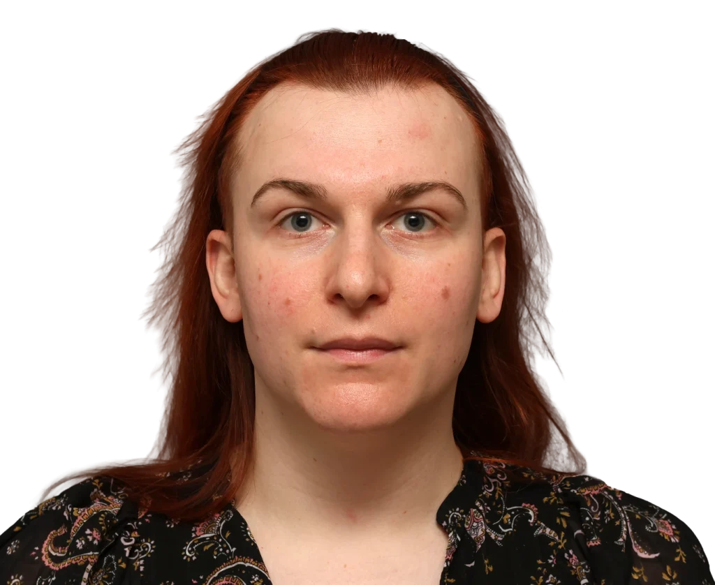 Frontal head‑and‑shoulders portrait of a woman with red hair and blue eyes, wearing a patterned black top against a dark background.