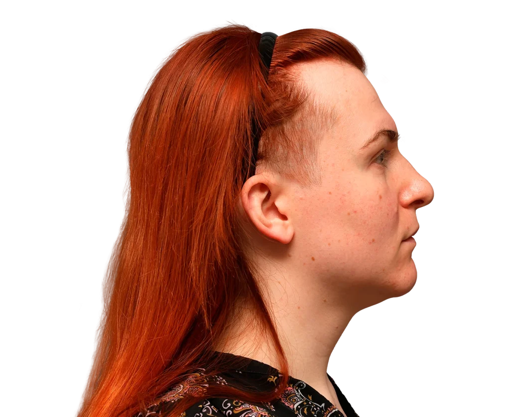 Profile view of a person with bright red hair and freckles, wearing a black headband, facing left.