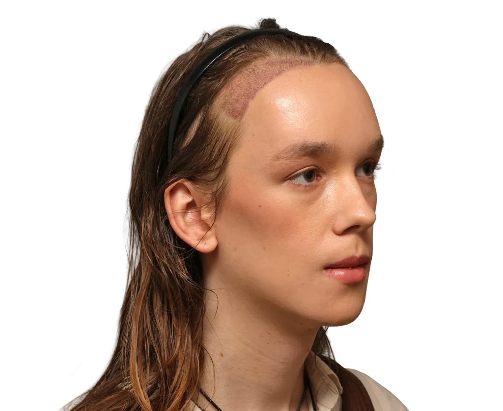 Woman with a shaved hairline on the temple, wearing a black headband, side view portrait